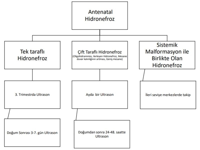 antenatal-hidronefroz